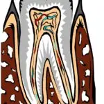 Diagram showing tooth layers and inner structure