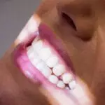 Close-up of a bright white smile under soft lighting